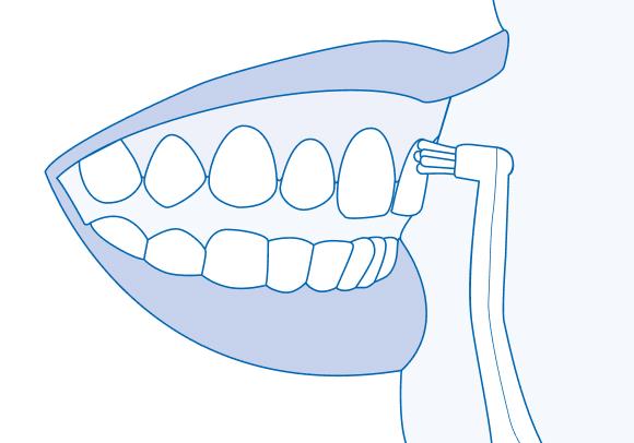 Гигиена зубов зубной щеткой CS single. Техника Соло