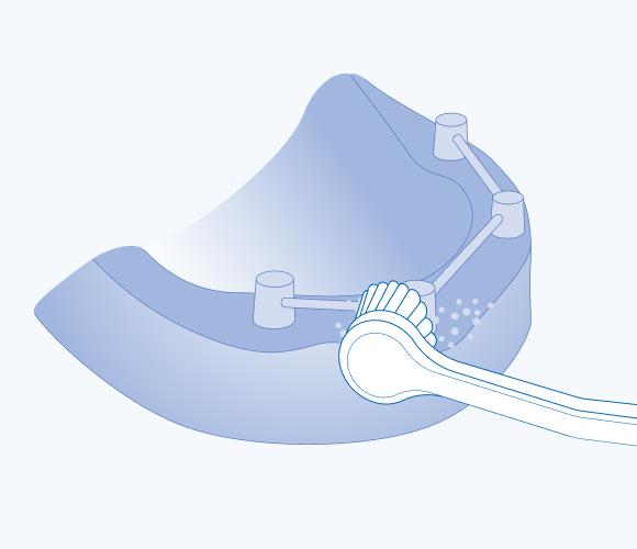 Гигиенический уход за имплантатами