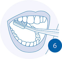 Правильная чистка зубов