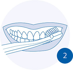 Правильная чистка зубов