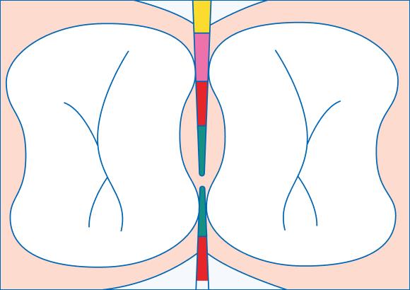 Правильно подобранный межзубный ершик играет важную роль