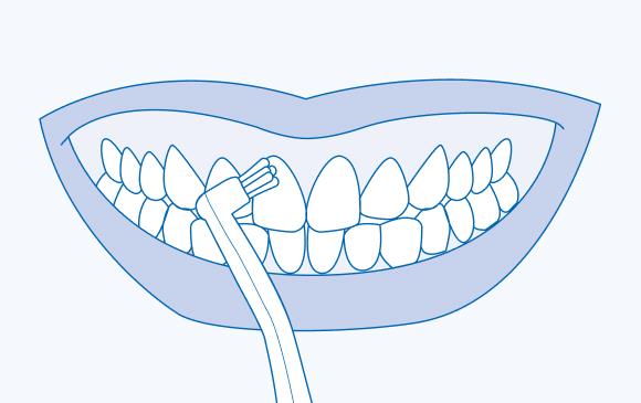 Гигиена зубов зубной щеткой CS single. Техника Соло