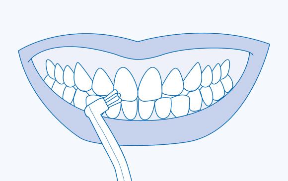 Гигиена зубов зубной щеткой CS single. Техника Соло