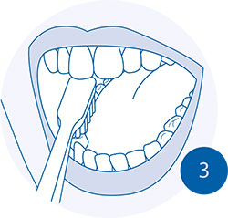 Правильная чистка зубов