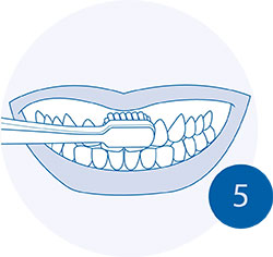 Правильная чистка зубов