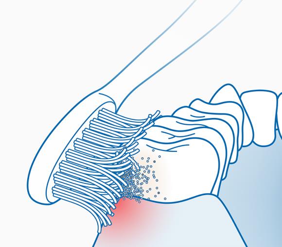 Жесткая или мягкая щетина щетки?