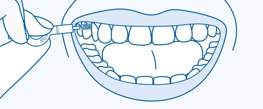 Правильно подобранный межзубный ершик играет важную роль