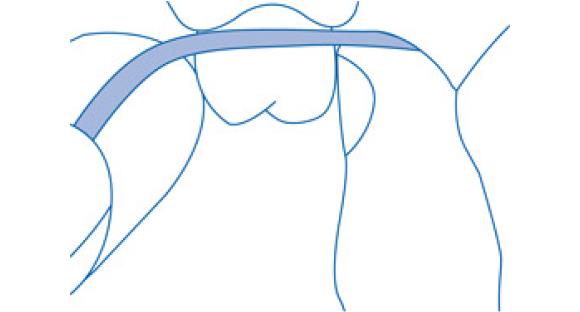 Атравматичная техника чистки дентальной нитью