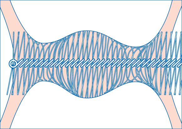 Правильно подобранный межзубный ершик играет важную роль