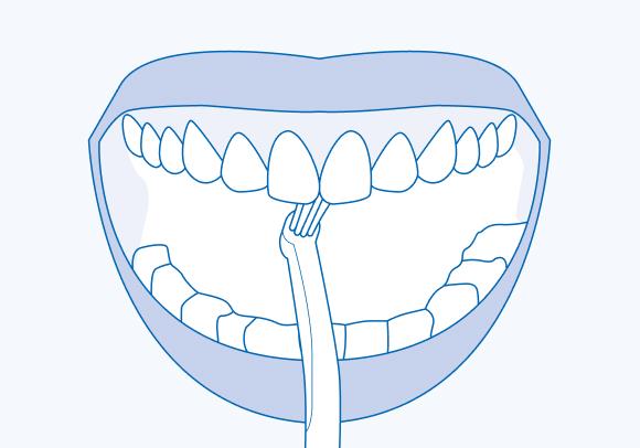 Гигиена зубов зубной щеткой CS single. Техника Соло