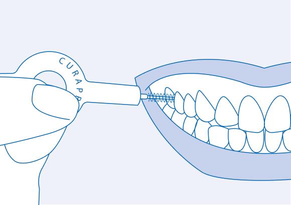 Правильно подобранный межзубный ершик играет важную роль