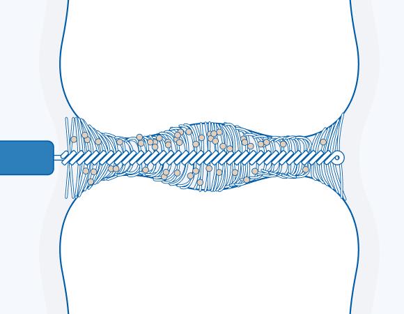 Зубная нить или межзубной ершик?