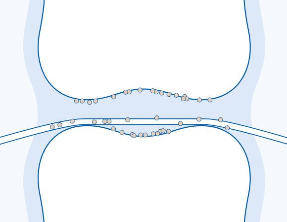 Зубная нить или межзубной ершик?